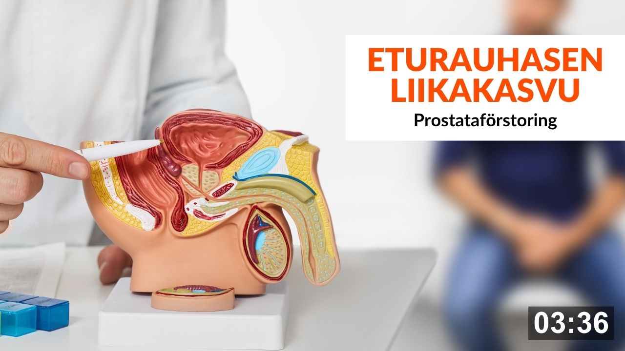 Eturauhasen-liikakasvu